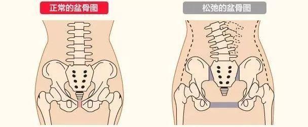 苏州国医堂孙国荣：如何正确进行产后骨盆修复(图1)