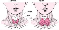 苏州国医堂孙嗣章：甲状腺对人体健康的作用