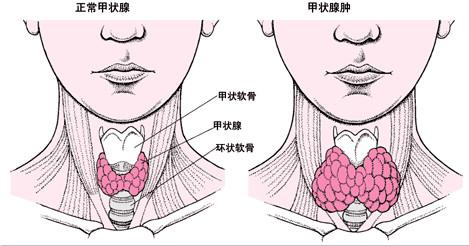 苏州国医堂孙嗣章：甲状腺对人体健康的作用(图1)