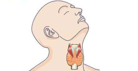 什么食物会导致甲状腺结节？苏州如何治疗此病？(图1)