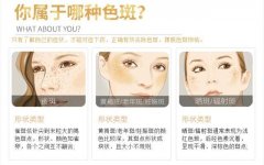 苏州祛斑,苏州国医堂孙为民：脸上为什么长斑
