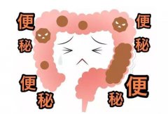 苏州看便秘，国医堂孙为民辨证便秘如何调理