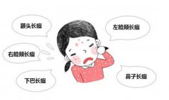 苏州哪里治疗粉刺好|老中医孙为民|一方搞定青春痘还能祛斑